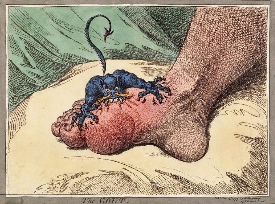 Gout was like a devil gnawing at your foot - James Gillray cartoon