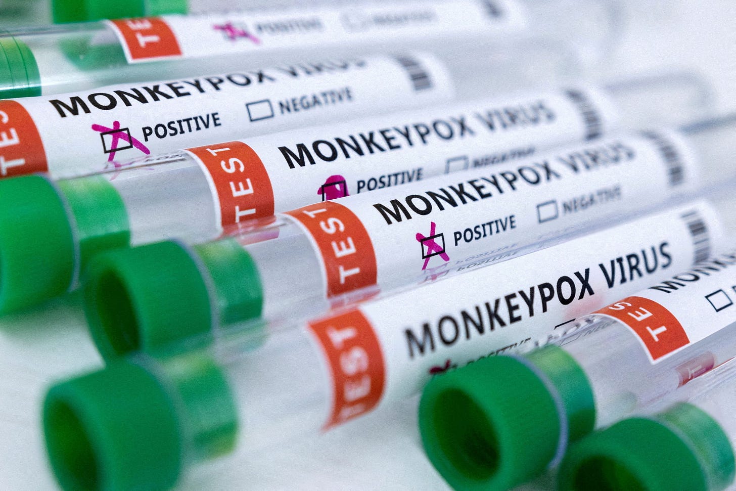 An adult with 'various severe illnesses' including monkeypox, has died in Texas