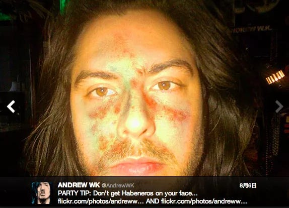 A photo of Andrew WK after rubbing habanero peppers on his face