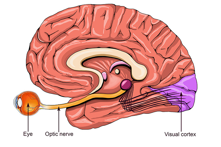 The optic nerve carries visual information to the brain