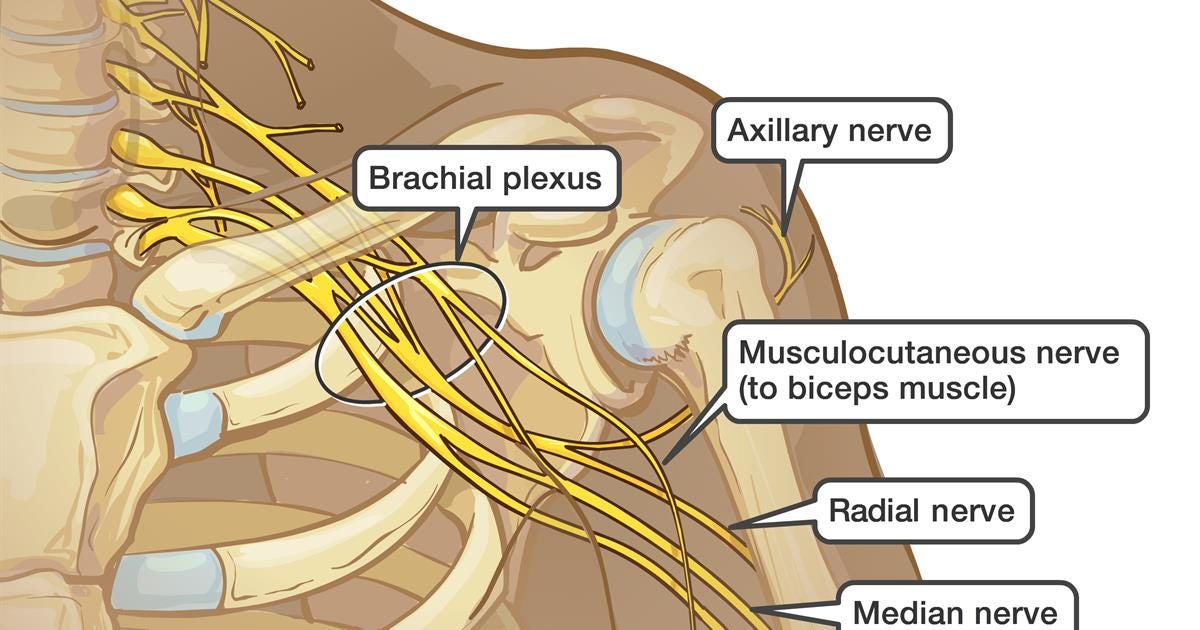 Brachial plexus operation
