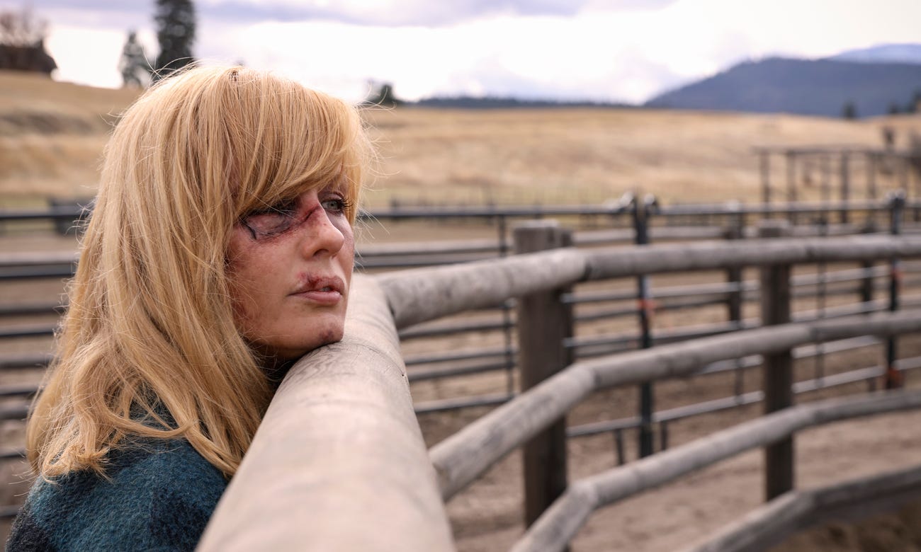 Yellowstone' Shows Off How It Creates Realistic Scars, Burn: VIDEO