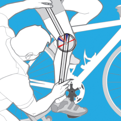 The Holmes Method making use of a goniometer.