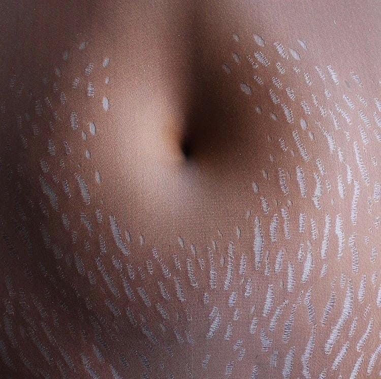 A fabric and needlework rendering of a belly with stretch marks.