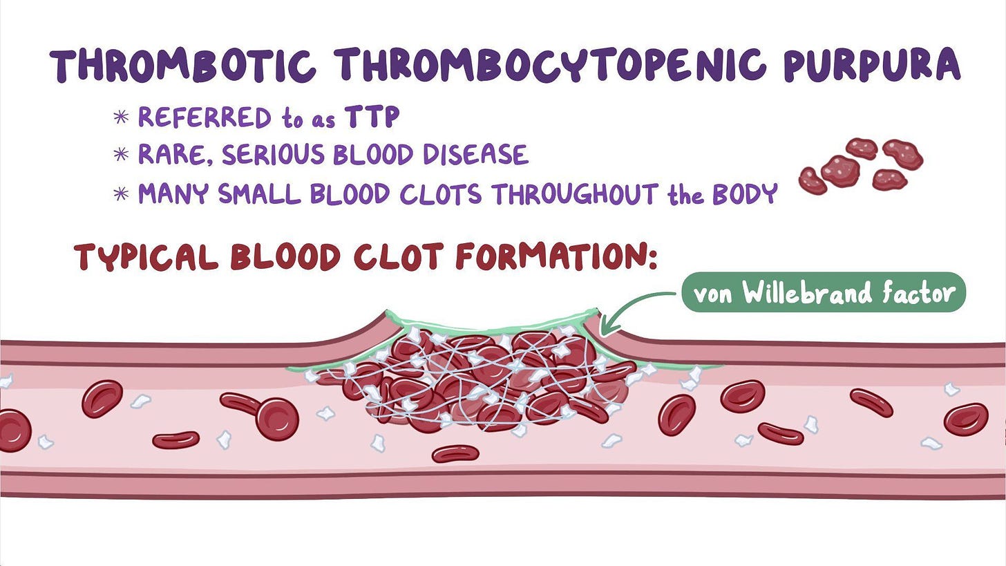 Thrombotic thrombocytopenic purpura (NORD) | Osmosis