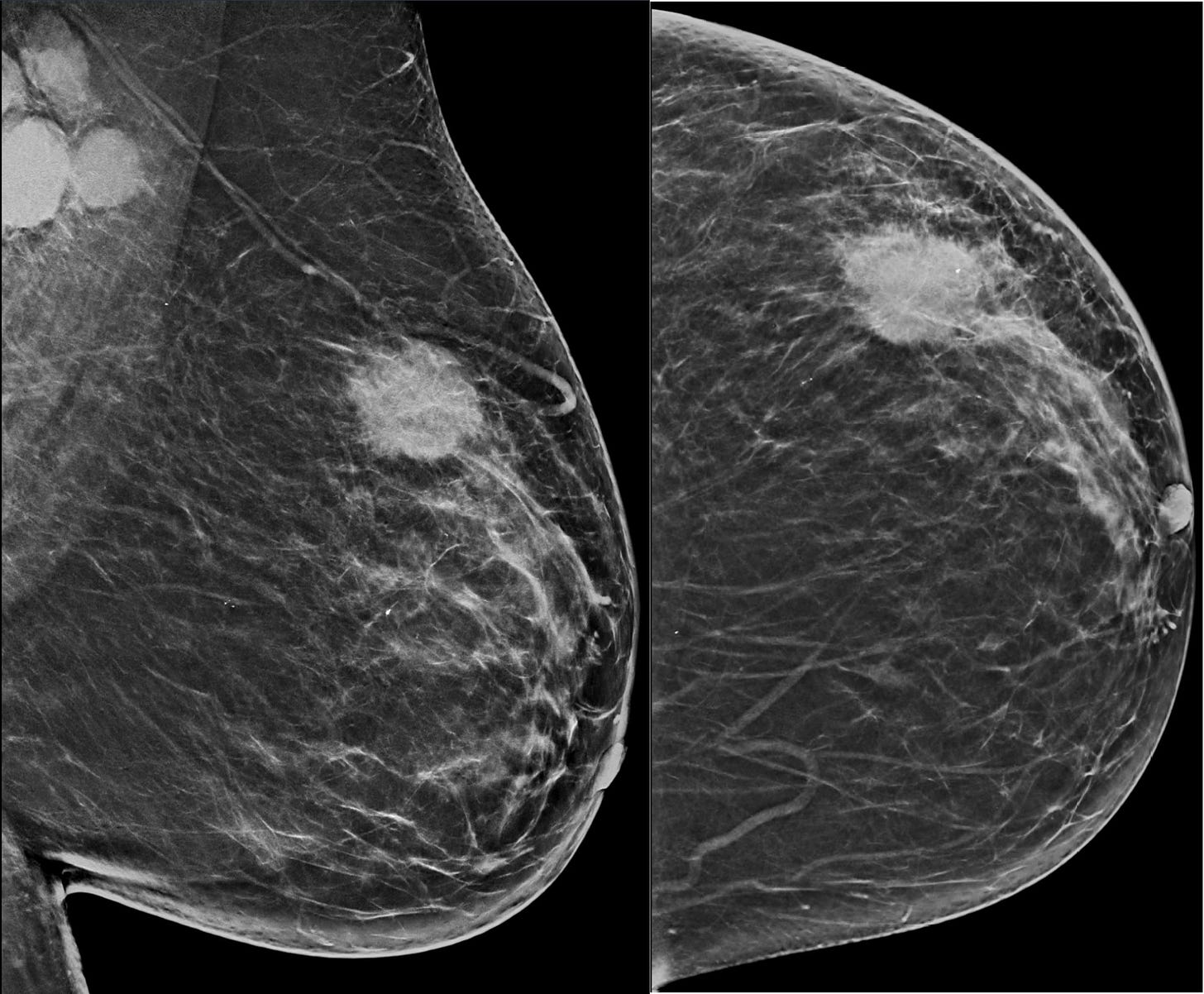 Breast imaging and careers - National Breast Imaging Academy