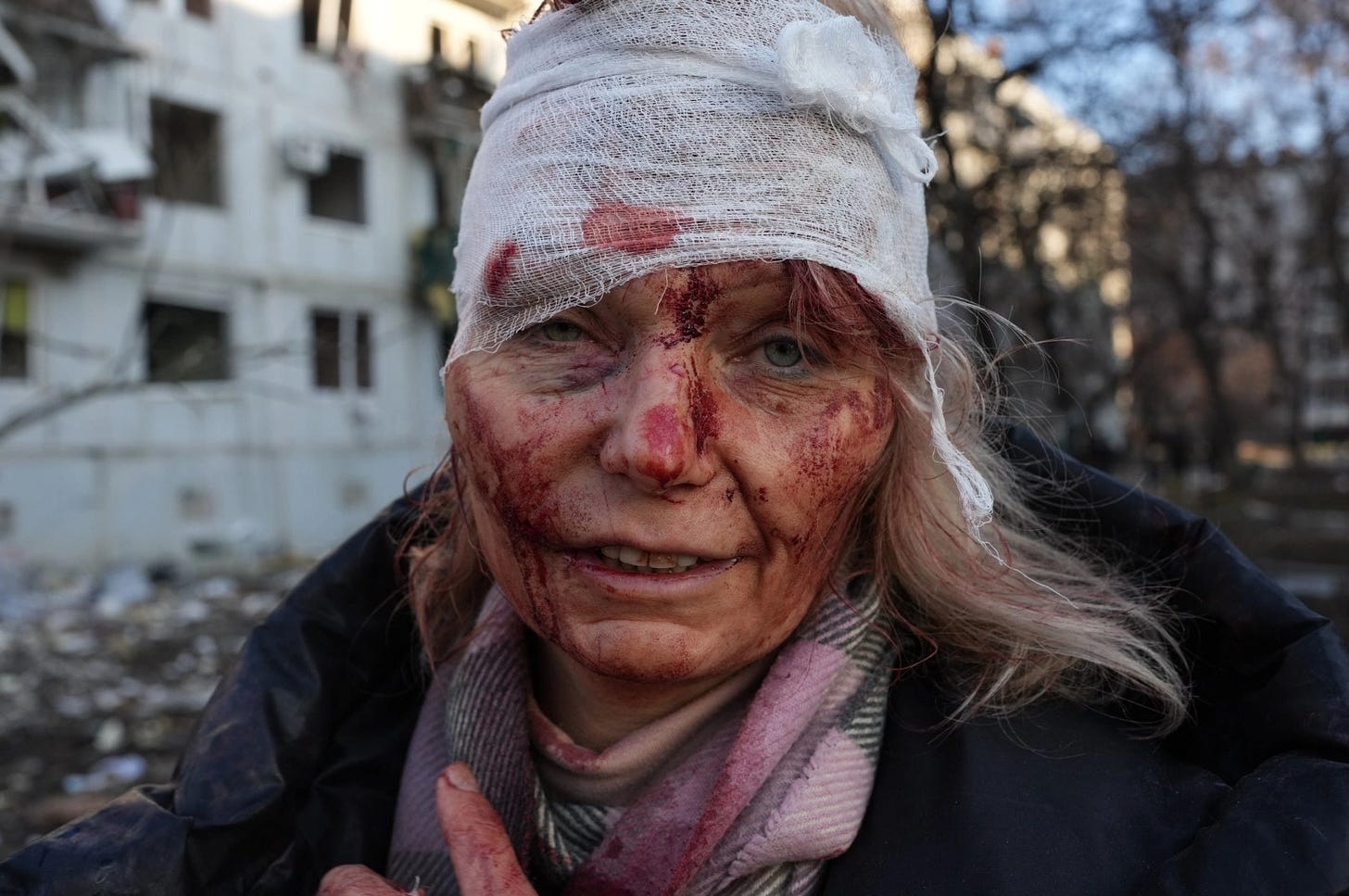 A wounded woman is seen as airstrike damages an apartment complex outside of Kharkiv