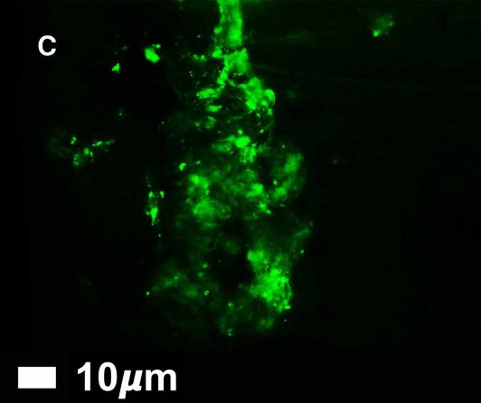 Microscope image of microclots: looks like blurry neon green blobs on a black background. The blobs are about 10 millionths of a meter wide.