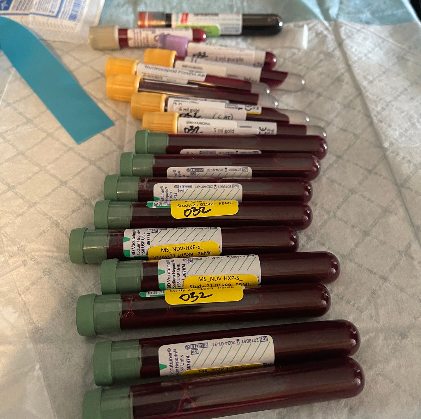 A photo of 17 blood vials that were drawn out of me on a regular basis