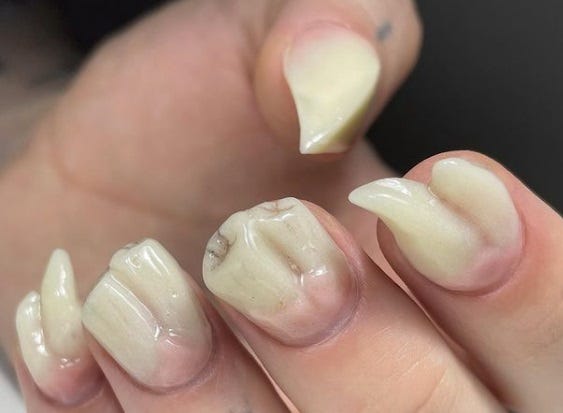 Photo of disturbingly lifelike fingernail sculptures that look like disfigured human teeth. 