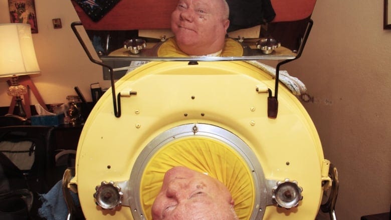 This lawyer is one of the last people alive who still uses an iron lung |  CBC Radio