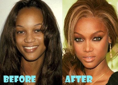 tyra banks before after nose job