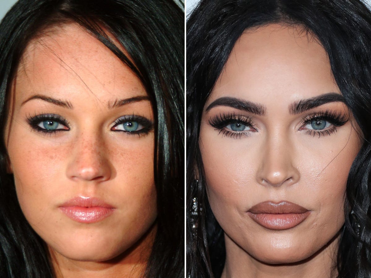 Megan Fox Before and After: From 2003 to 2022 - The Skincare Edit