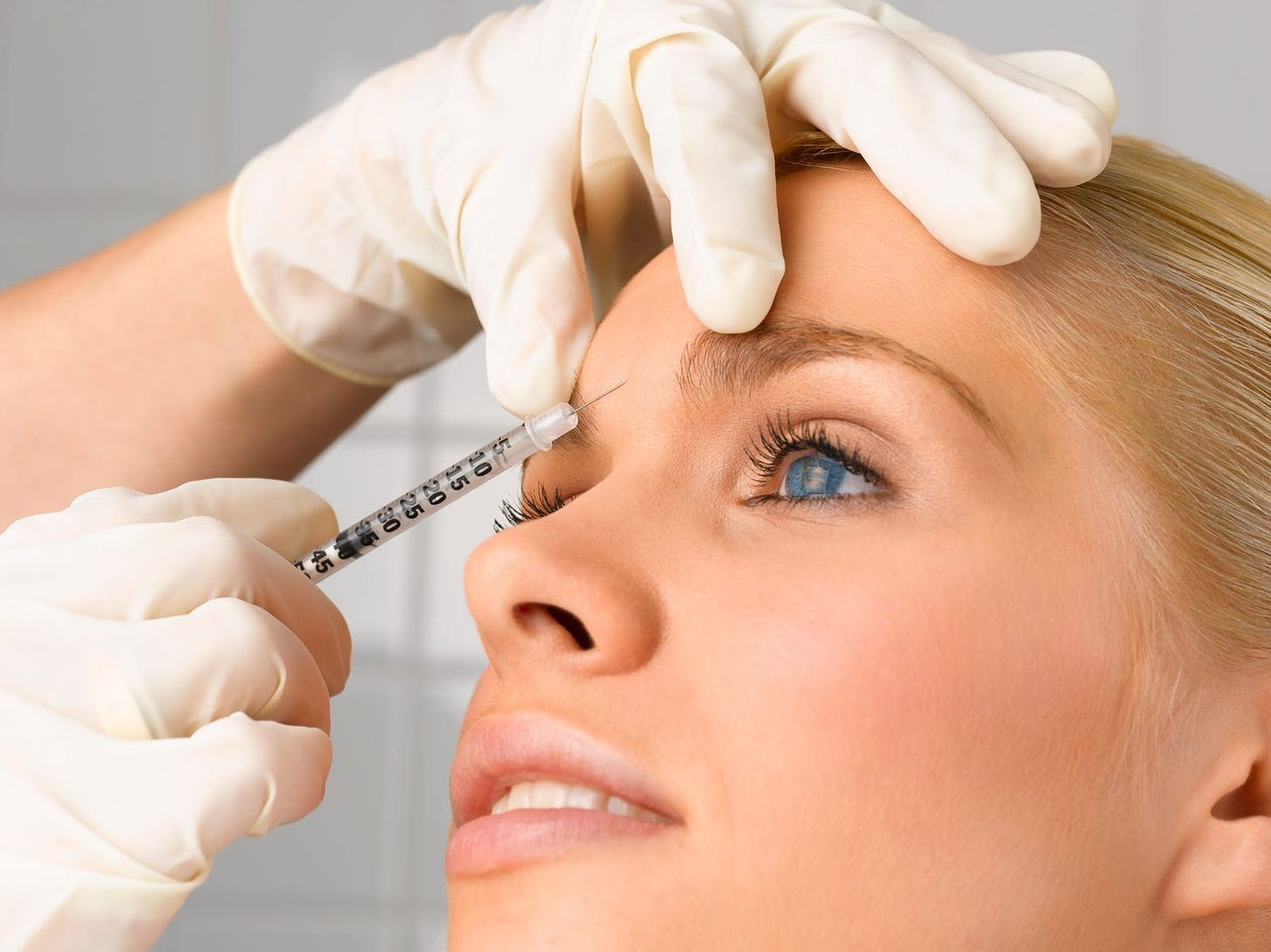 Botox vs. Fillers: Which Injectable Is Right for You?