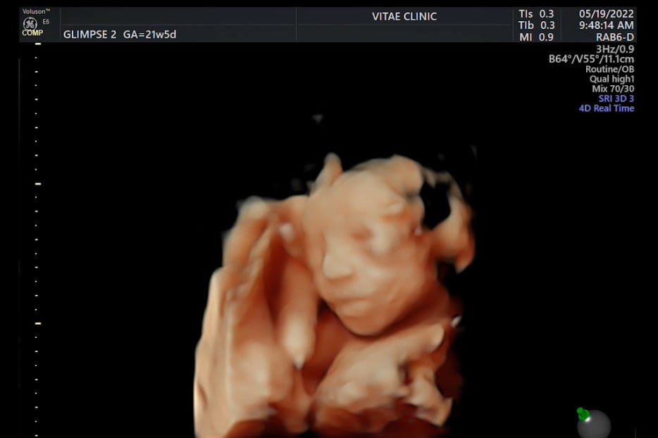 Awe-inspiring ultrasound imaging. courtesy 