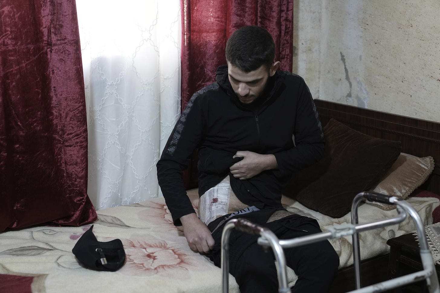 Mohammed Rimawi shows his injury from an Israeli military shooting.