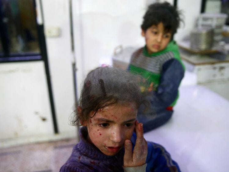 Wounded children are seen in a hospital in the besieged town of Douma, Eastern Ghouta, Damascus