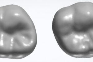 Natural tooth (left) compared with tooth tailored by generative AI (right).