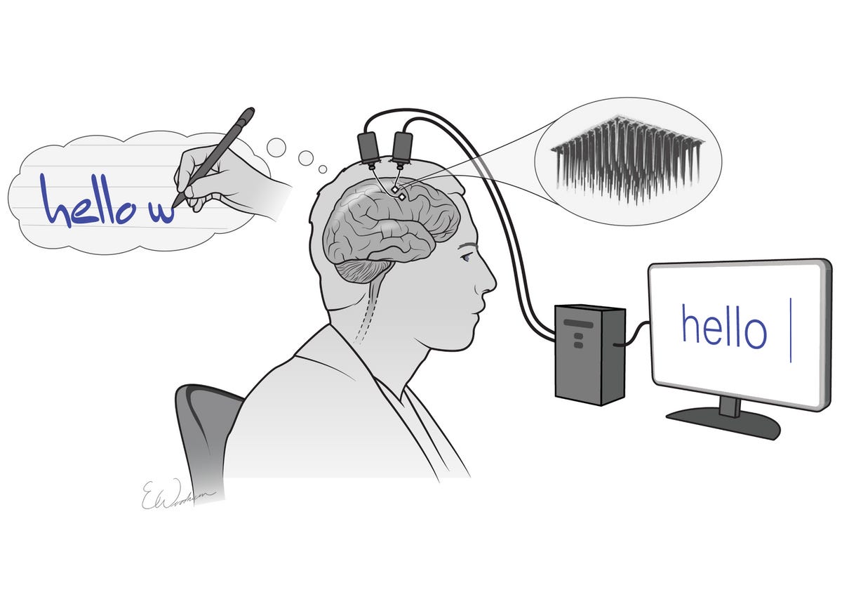Brain-Computer Interface User Types 90 Characters Per Minute with Mind |  The Scientist Magazine®