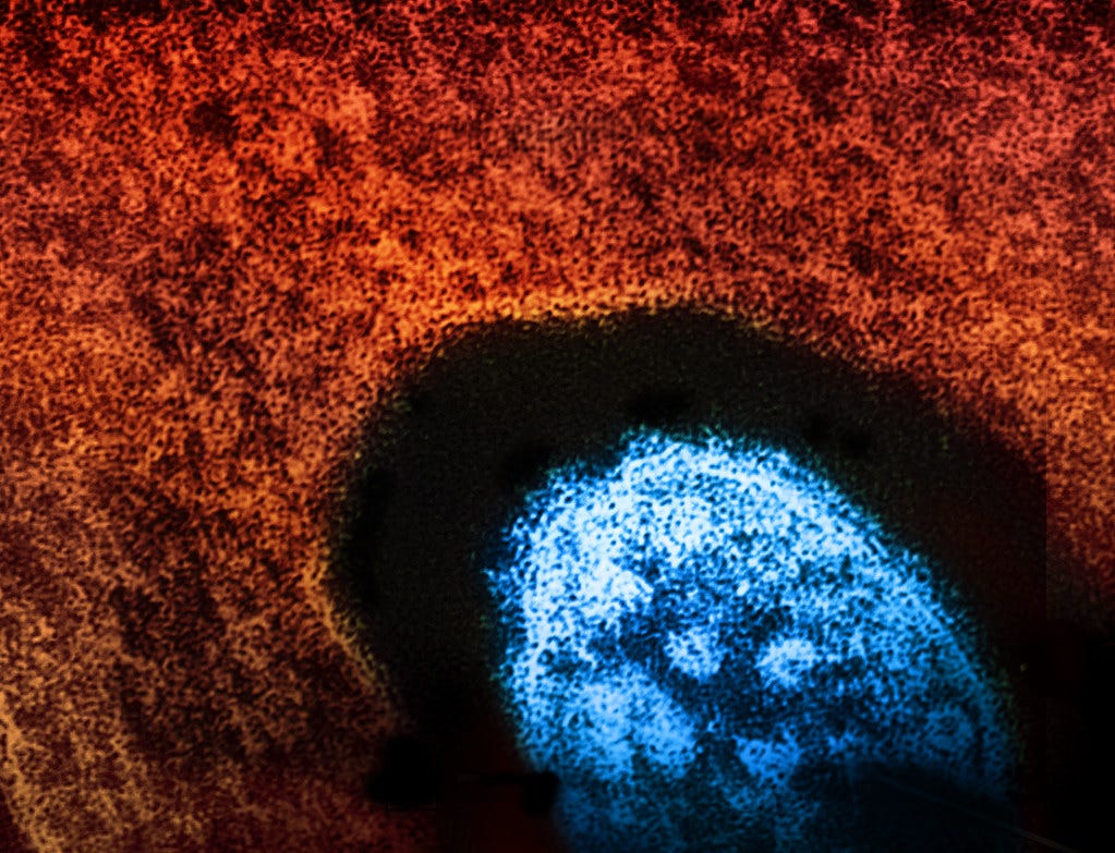 Measles Virus Particle | by NIAID