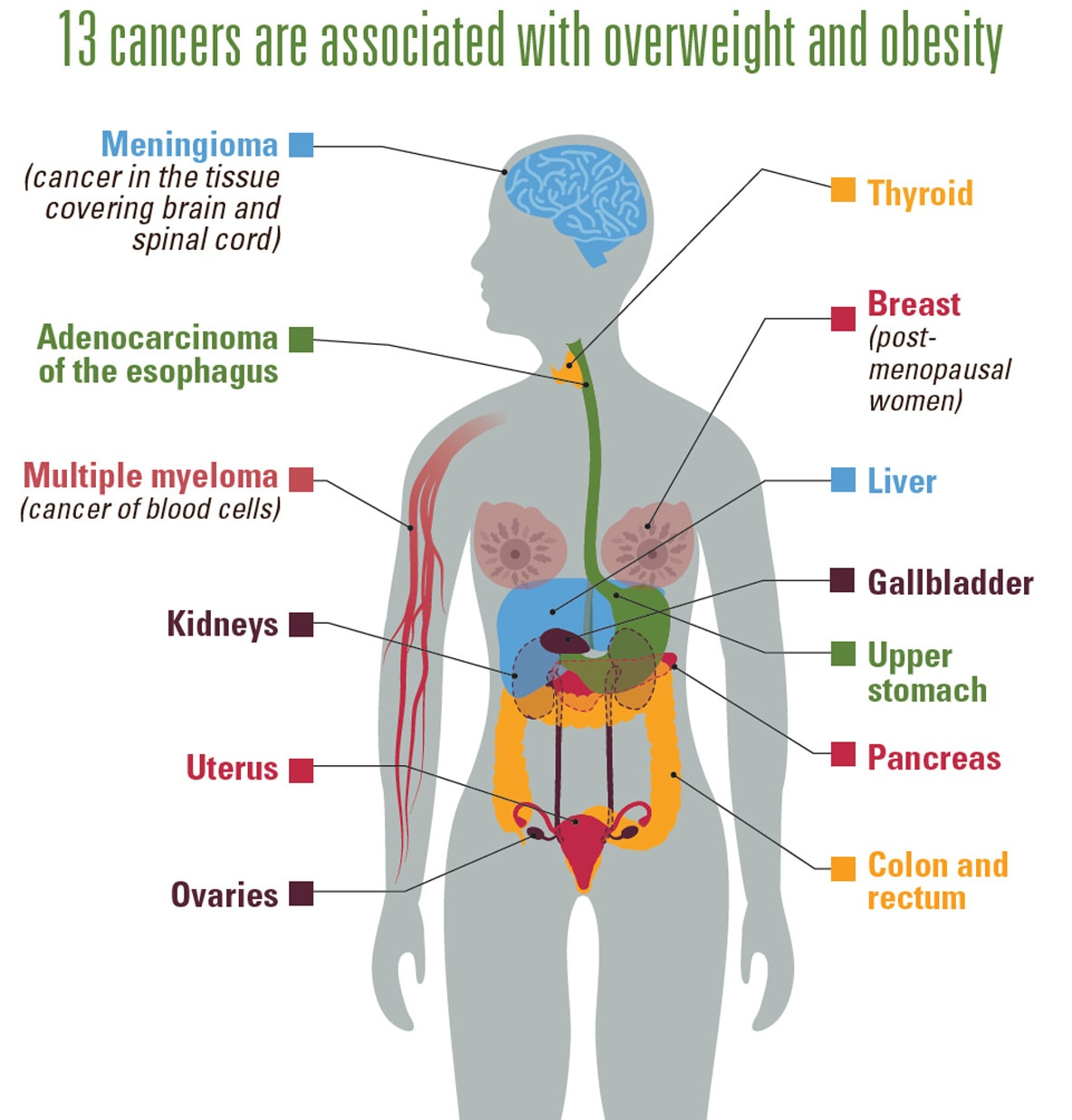 Cancer and obesity | VitalSigns | CDC