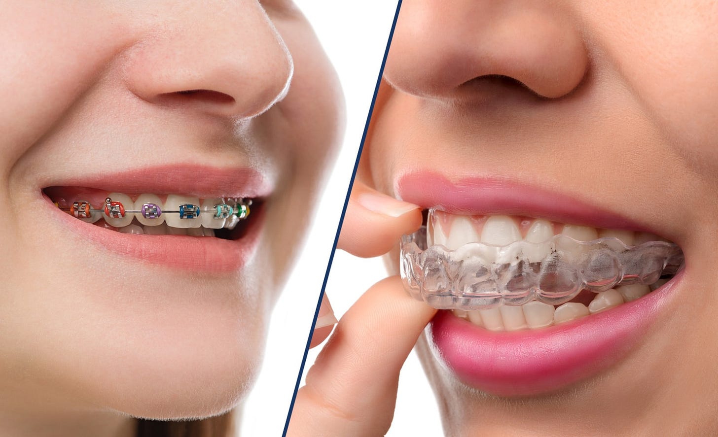 Braces vs. Invisalign | Leber Orthodontics | Tucson Braces