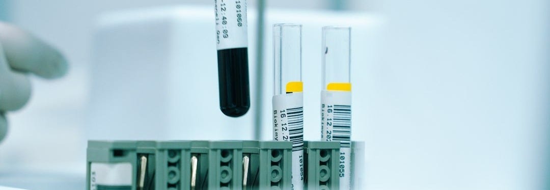 a gloved hand holding a test tube filled with liquid a gloved hand holding a test tube filled with liquid