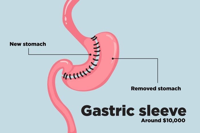 A diagram of a stomach

Description automatically generated
