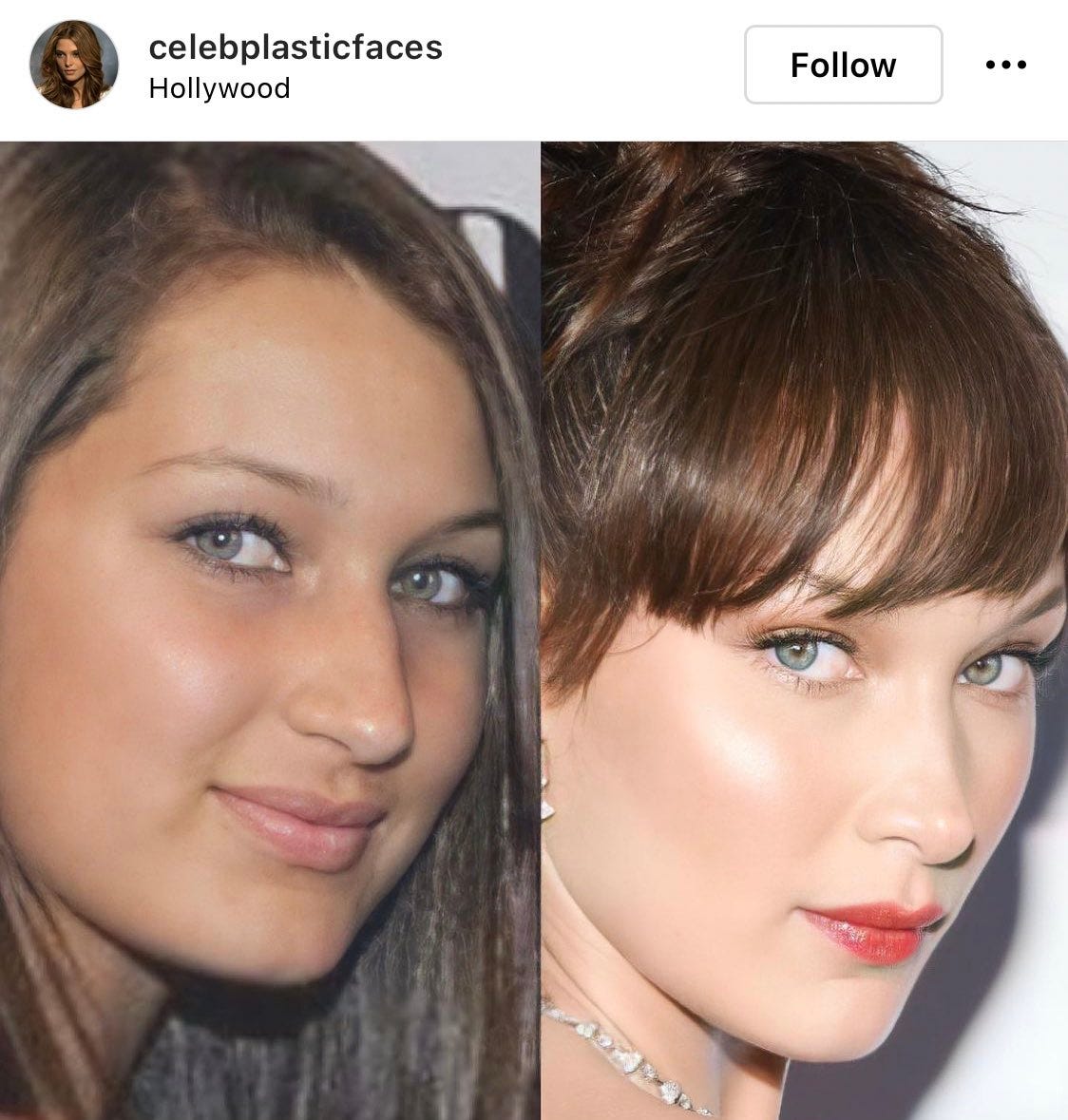 Bella Hadid's Nose Job At 14 Sparks Conversation Around Yolanda's Praise Of  Gigi Hadid's Eurocentric Features