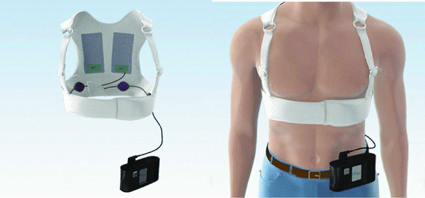 Wearable Cardioverter Defibrillator A Literal LifeVest For Your Heart