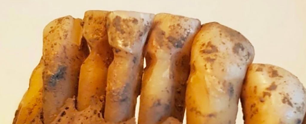 Cientistas estudaram 3.000 dentes Viking e descobriram uma odontologia surpreendentemente avançada. Cientistas estudaram 3.000 dentes Viking e descobriram uma odontologia surpreendentemente avançada.