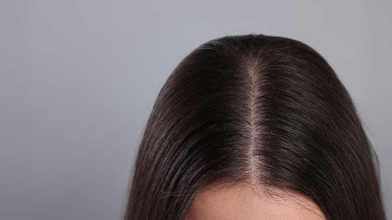 scalp microbiome