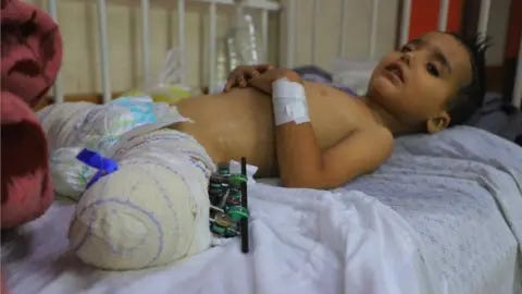 Wounded child, no surviving family': The pain of Gaza's orphans