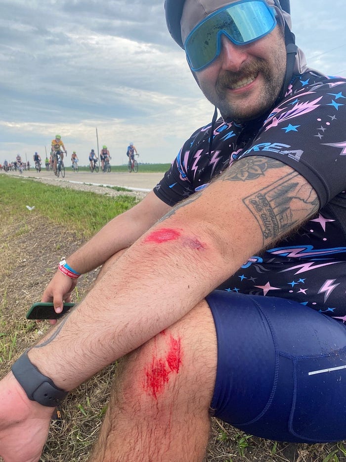 a cyclist with tattoos sits on the side of the road. he has two road rash scrapes on his elbow and knee. he is smiling.