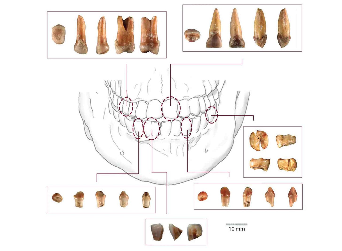 Images of teeth in multiple views, with arrows pointing into a jaw to show the tooth positions Images of teeth in multiple views, with arrows pointing into a jaw to show the tooth positions