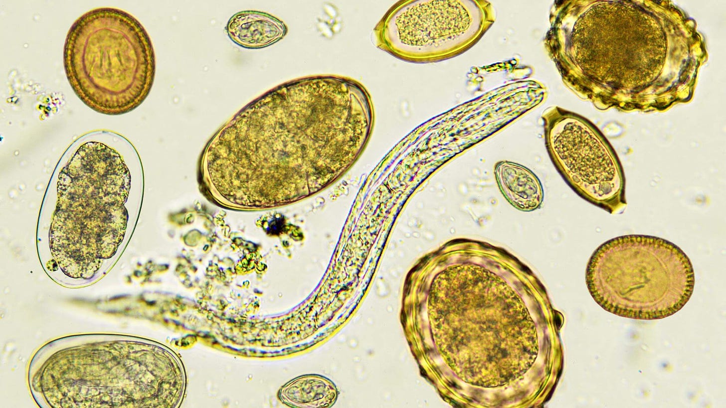 Blastocystis Hominis Parasite - How & why to clear it