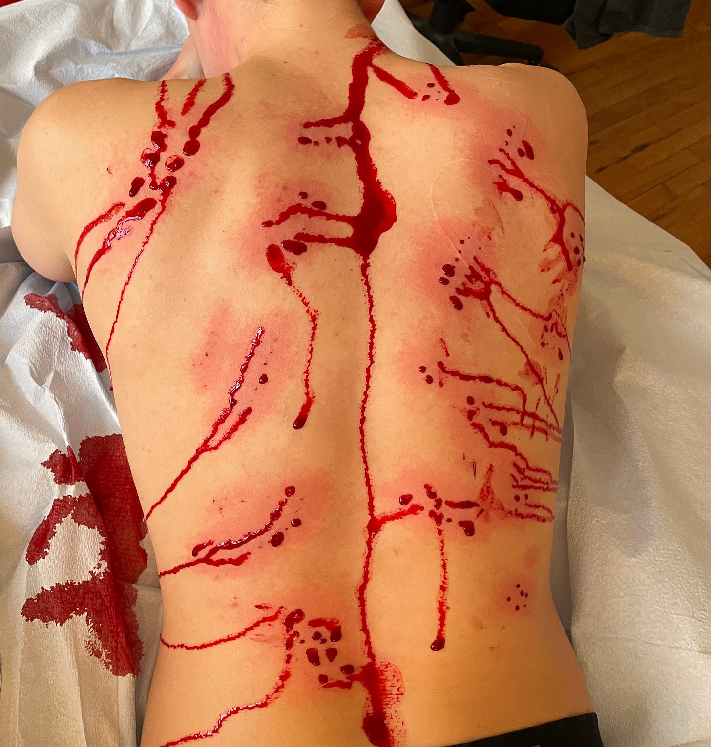 David's back with needle holes and blood