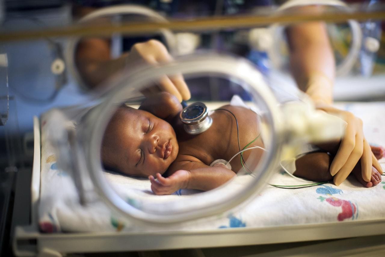 How Steroids Reduce Preterm Birth Complications
