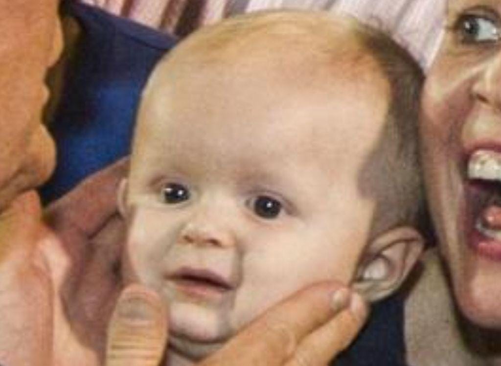 closeup of trump grabbing baby's face, baby is not thrilled. its mom is making an out-of-control face beside it