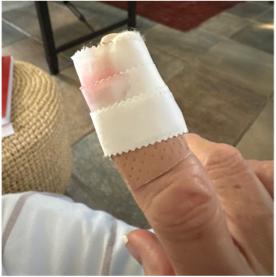 A person's finger with a bandage on it

Description automatically generated
