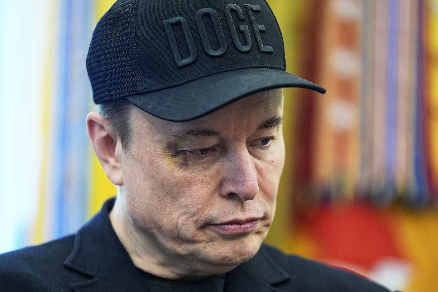 Elon Musk Shows Up with Black Eye at Oval Office Meeting, Blames Young Son