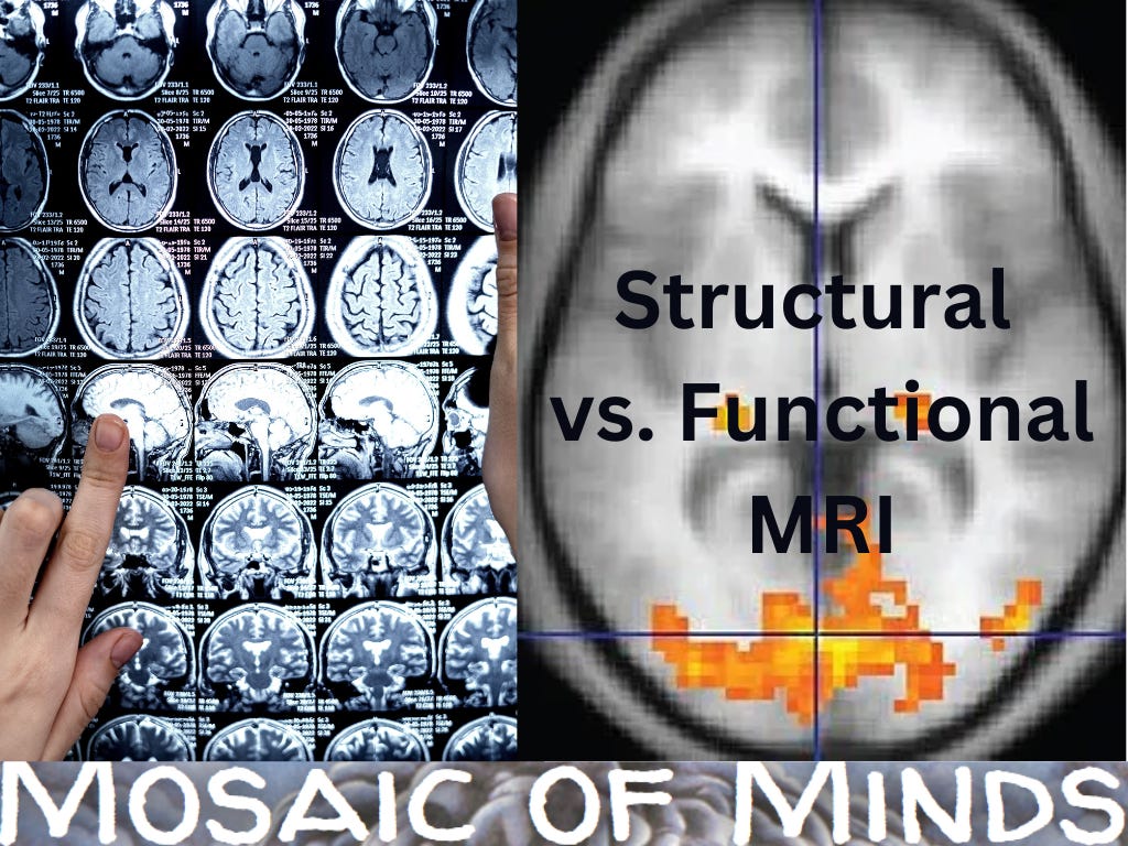 Blog header image with a structural MRI scan on the left and a functional MRI image on the right.