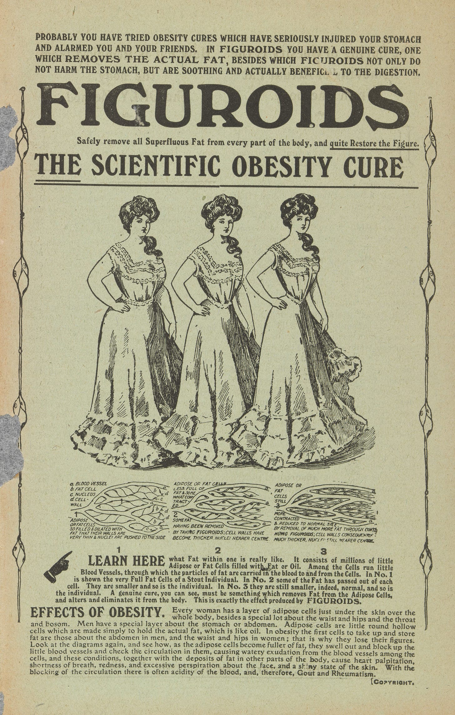 A printed pamphlet headlined 'Figuroids: The Scientific Obesity Cure.' There are three drawings of a woman getting progressively slimmer from left to right. Under the drawings there are diagrams showing fat cells.