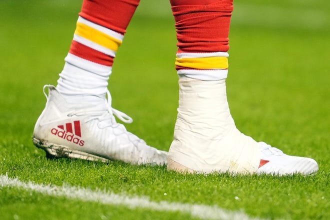 Just a picture of Patrick Mahomes ankle. : r/KansasCityChiefs