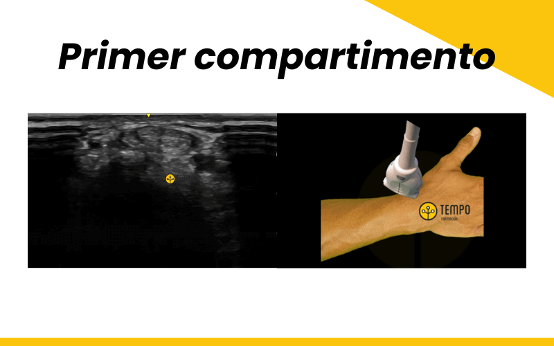 1. Primer compartimento muñeca ecografia Tempo Formacion.png