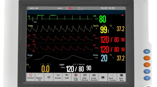 Le monitoring des patients comme aide à la prise de décision médicale