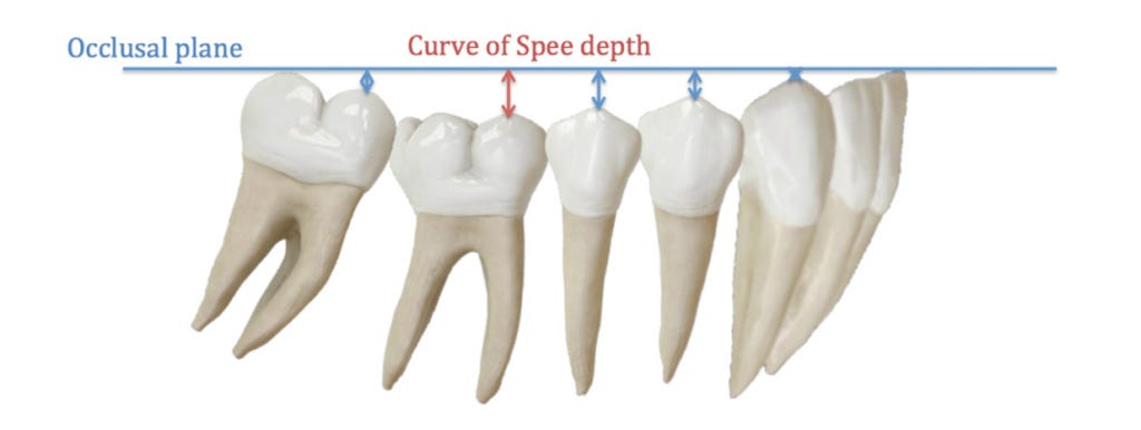 How should we level the curve of Spee with aligners? - Smart Aligner  Services