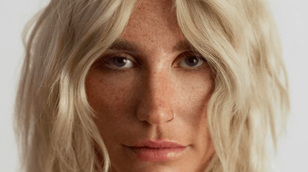 Kesha revela que “quase morreu” após realizar congelamento de óvulos | CNN  Brasil