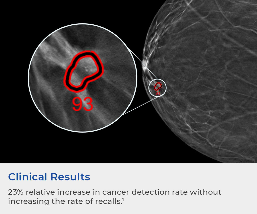 Improve Workstation Readability with ProFound AI Detection v3 Service Pack  | iCAD