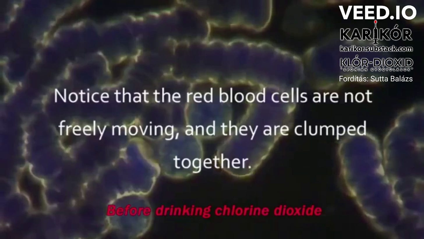 A klór-dioxid (CDS) vérre, illetve a hemoglobinra gyakorolt hatása, orális, illetve a vérrel történő közvetlen találkozásakor (MAGYAR HANGGAL)